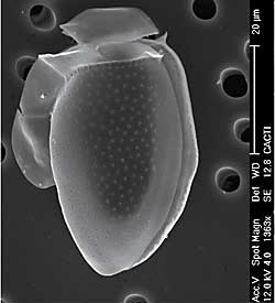 Dinophysis acuminata